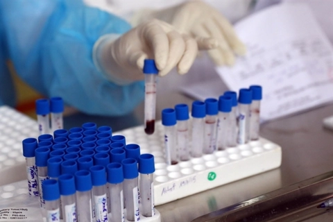 Vietnam starts research for Covid-19 vaccine