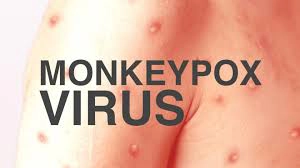 Vietnam records first monkeypox case